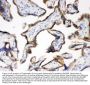 Anti-Cytokeratin 19/KRT19 Antibody Picoband®