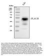 Anti-uPA Receptor/PLAUR Antibody Picoband®