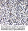 Anti-uPA Receptor/PLAUR Antibody Picoband®