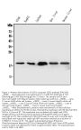 Anti-Superoxide Dismutase 1/SOD1 Antibody Picoband®