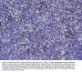 Anti-Superoxide Dismutase 1/SOD1 Antibody Picoband®