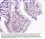 Anti-Superoxide Dismutase 1/SOD1 Antibody Picoband®