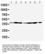 Anti-Annexin A2/ANXA2 Antibody Picoband®