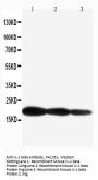 Anti-IL1 beta/IL1B Antibody Picoband®