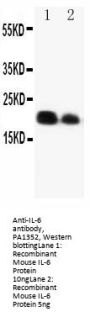 Anti-Interleukin-6 IL6 Antibody Picoband®