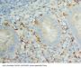 Anti-IL8/CXCL8 Antibody Picoband®