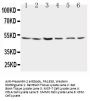 Anti-Presenilin 2/PSEN2 Antibody Picoband®
