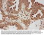 Anti-Calpain 1/CAPN1 Antibody Picoband®
