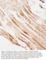 Anti-Calpain 1/CAPN1 Antibody Picoband®