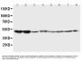 Anti-5HT2A Receptor/HTR2A Antibody Picoband®