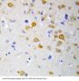 Anti-5HT2A Receptor/HTR2A Antibody Picoband®