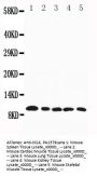 Anti-Macrophage Inflammatory Protein 1 beta/CCL4 Antibody Picoband®