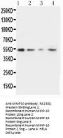 Anti-Stromelysin-2 MMP10 Antibody Picoband®