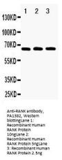 Anti-RANK/TNFRSF11A Antibody Picoband®
