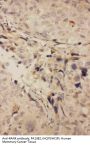 Anti-RANK/TNFRSF11A Antibody Picoband®