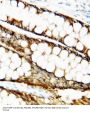Anti-Metalloproteinase inhibitor 1 TIMP1 Antibody Picoband®