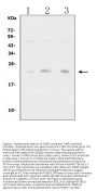 Anti-Metalloproteinase inhibitor 1 TIMP1 Antibody Picoband®