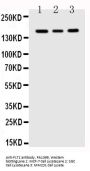 Anti-VEGF Receptor 1/FLT1 Antibody Picoband®