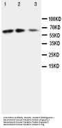 Anti-Fractalkine CX3CL1 Antibody Picoband®