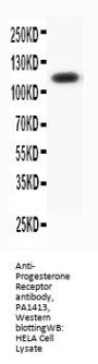 Anti-Progesterone Receptor/PGR Antibody Picoband®