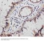 Anti-Progesterone Receptor/PGR Antibody Picoband®
