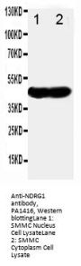 Anti-Protein NDRG1 NDRG1 Antibody Picoband®