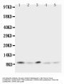 Anti-Ubiquitin/UBB Antibody Picoband®