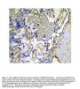 Anti-Galectin 1/LGALS1 Antibody PicobandÂ®
