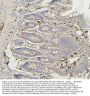 Anti-BAK/BAK1 Antibody Picoband®