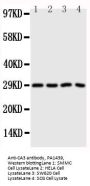 Anti-Carbonic Anhydrase III/CA3 Antibody Picoband®