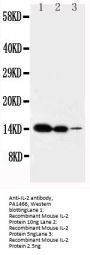 Anti-Interleukin-2 IL2 Antibody Picoband®
