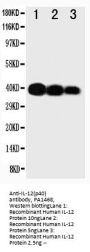 Anti-IL12 p40/IL12B Antibody Picoband®