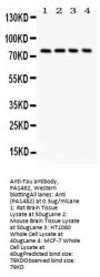 Anti-Tau/MAPT Antibody Picoband®