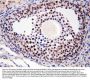 Anti-MTA1 Antibody Picoband®