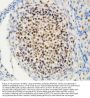 Anti-MTA1 Antibody Picoband®