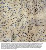 Anti-MTA1 Antibody Picoband®