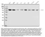Anti-MTA1 Antibody Picoband®