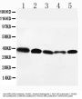 Anti-GPR2/CCR10 Antibody Picoband®