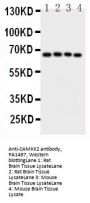 Anti-CAMKK2 Antibody Picoband®