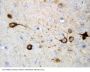 Anti-CAMKK2 Antibody Picoband®