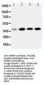 Anti-IGFBP3 Antibody Picoband®