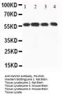 Anti-CaMKK/CAMKK1 Antibody Picoband®