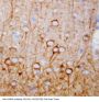 Anti-CaMKK/CAMKK1 Antibody Picoband®