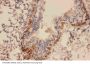 Anti-Canstatin Antibody Picoband®