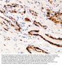 Anti-Canstatin Antibody Picoband®