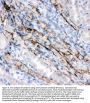 Anti-Canstatin Antibody Picoband®