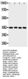 Anti-ATF4 Antibody Picoband®