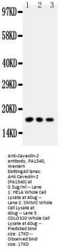 Anti-Caveolin-2/CAV2 Antibody Picoband®