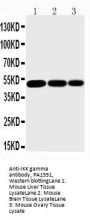 Anti-IKK gamma/IKBKG Antibody Picoband®