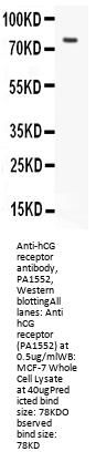 Anti-hCG receptor/LHCGR Antibody Picoband®